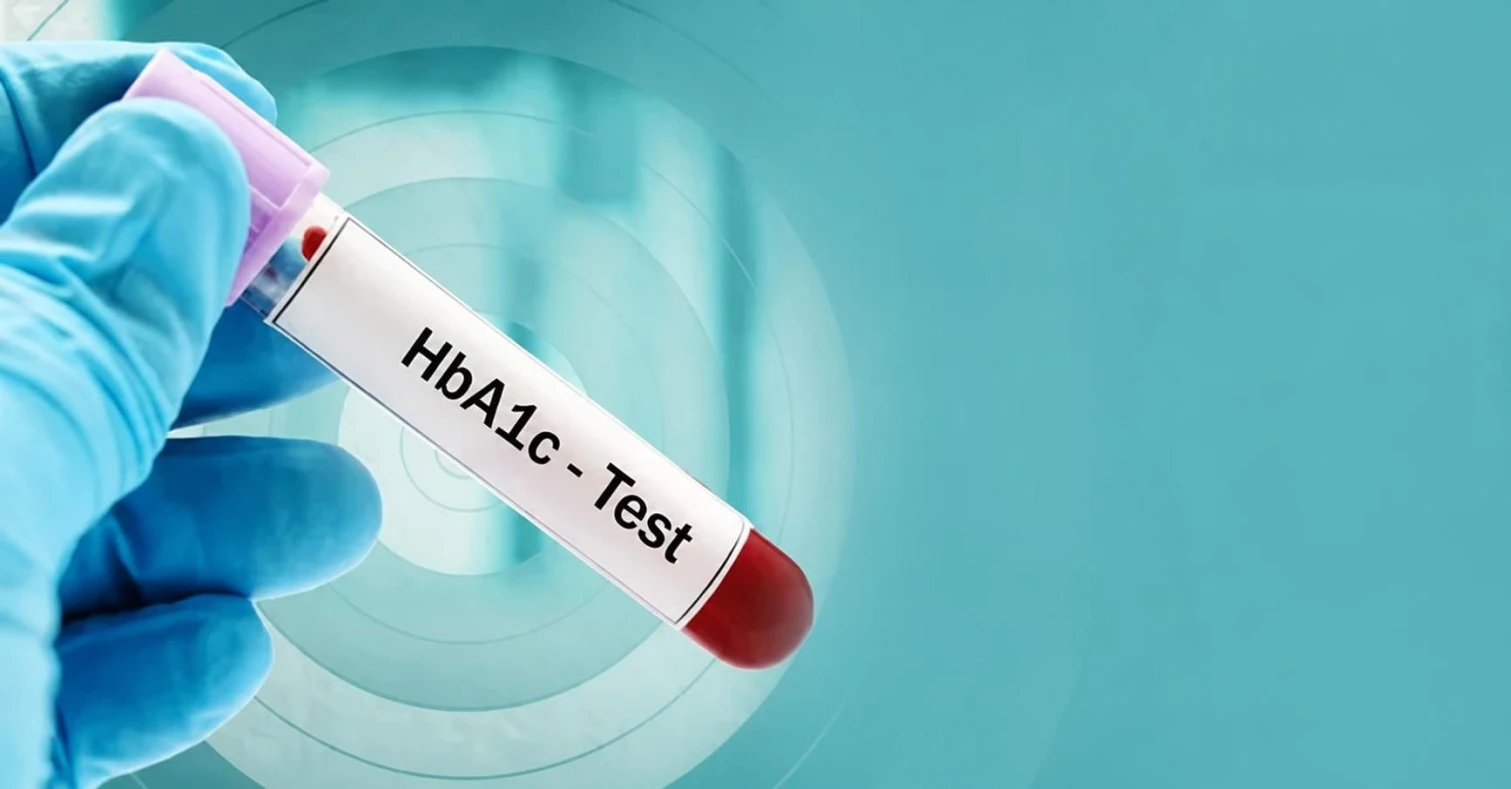 HbA1c : comprendre son résultat et son objectif