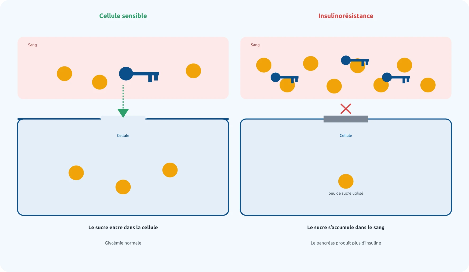 Schéma de l’insulinorésistance : à gauche l’insuline ouvre la cellule et le sucre entre, à droite la cellule résiste et le sucre s’accumule dans le sang